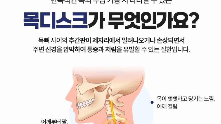 김해바른병원 — 목디스크의 정의와 증상을 설명하는 일러스트가 포함된 홍보용 포스터 이미지입니다.