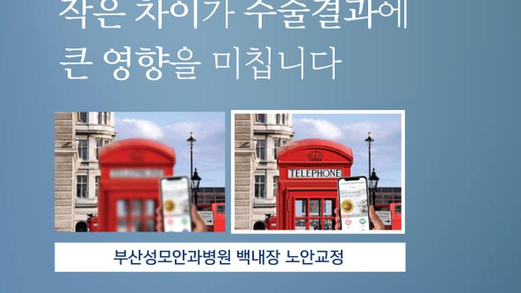 부산성모안과병원 — 안과 병원의 광고 문구와 두 장의 비교 사진이 포함된 홍보 이미지입니다