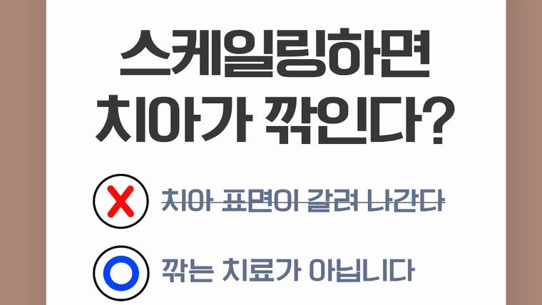 서울에스원치과의원 — 스케일링 치료에 대한 오해를 바로잡는 내용이 적힌 안내 포스터입니다