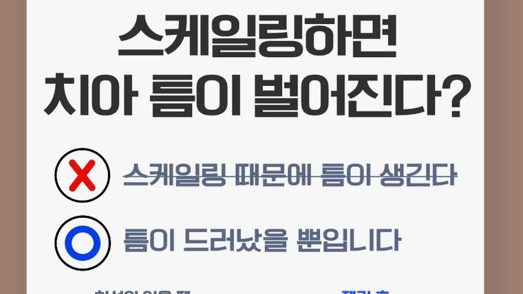 서울에스원치과의원 — 치아 스케일링에 대한 오해를 바로잡는 내용이 적힌 홍보용 안내문이다