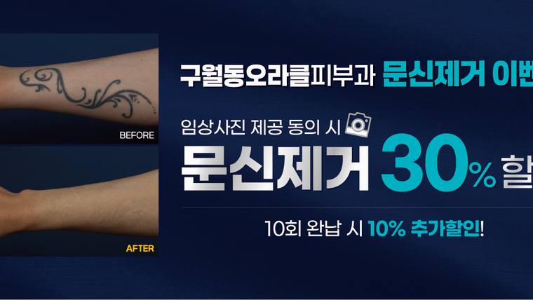 구월동 오라클피부과의원 — 문신 제거 전후 비교 사진과 할인 혜택이 적힌 병원 홍보용 포스터이다